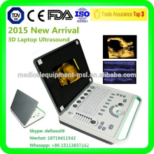 MSLPU34A portable 3d ultrasound scanner